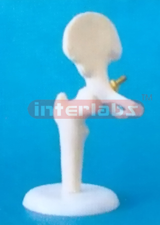 LITTLE HIP JOINT MODEL